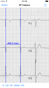 Measuring RR interval, iPhone 6 Plus