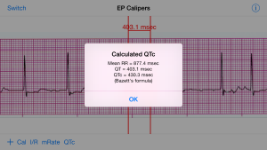 QT measurement with QTc calculation